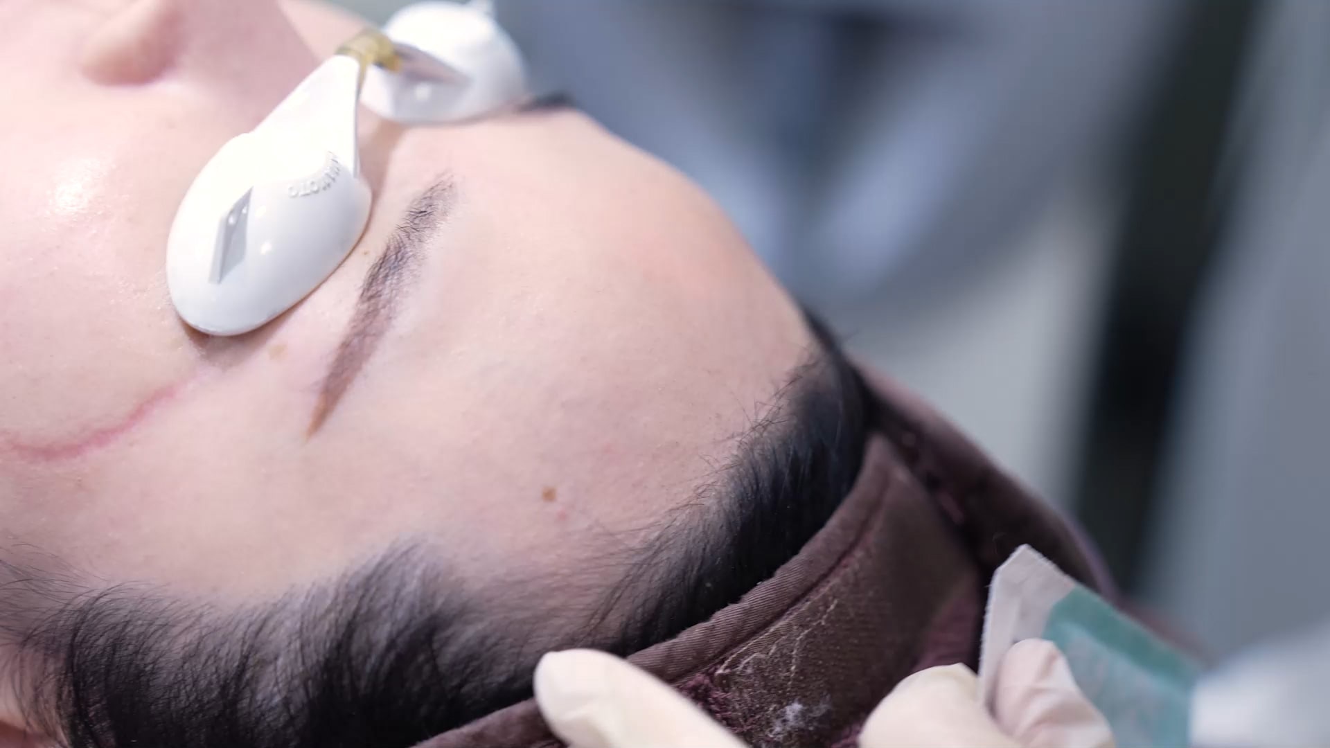 제모/탈모 | 인천오라클피부과 구월점 · 송도점